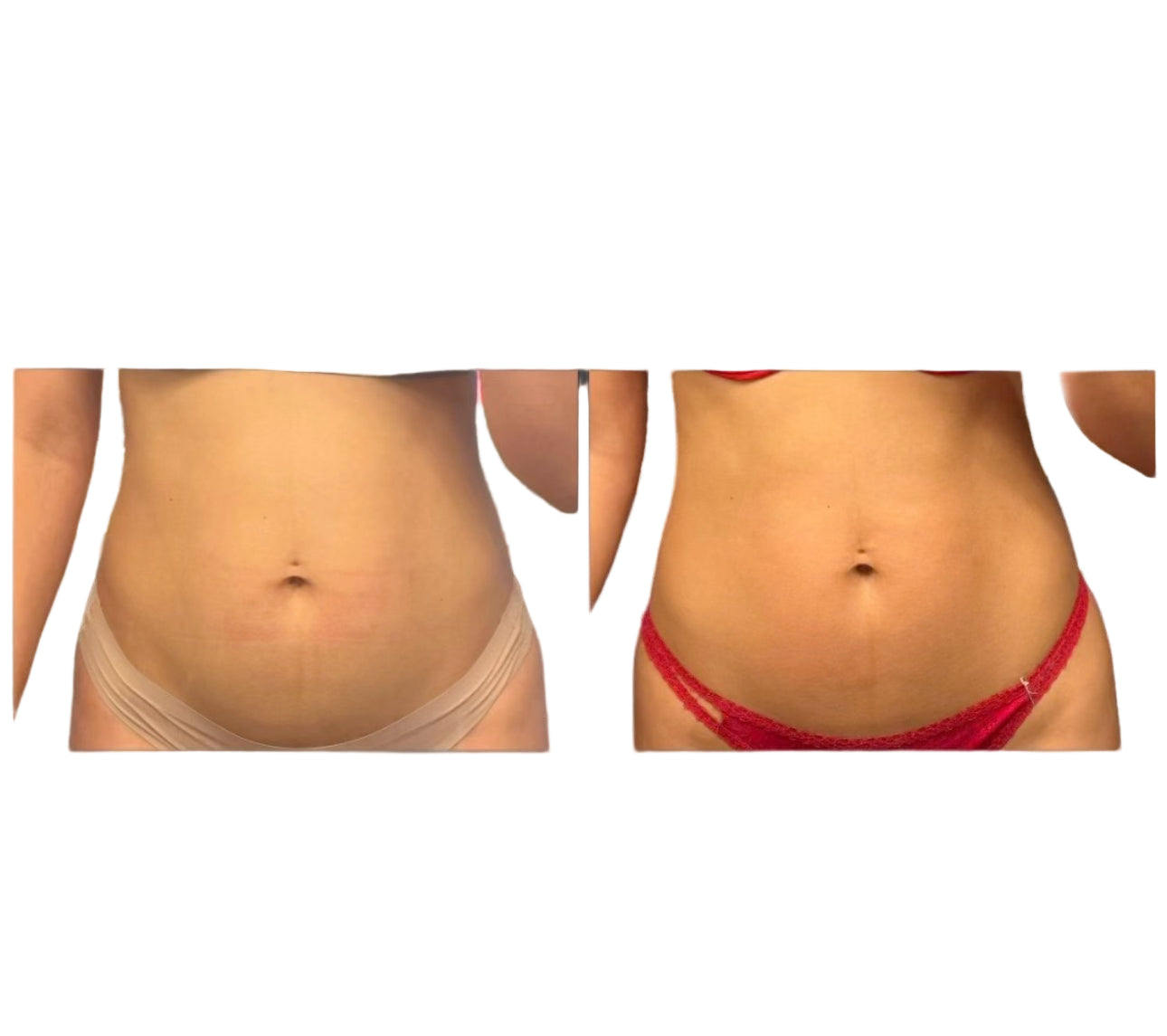 Bundle 3 get 1 free SculptMe Body Tightening Cream