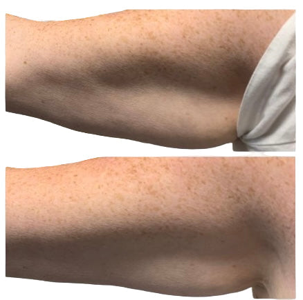 Bundle 3 get 1 free SculptMe Body Tightening Cream