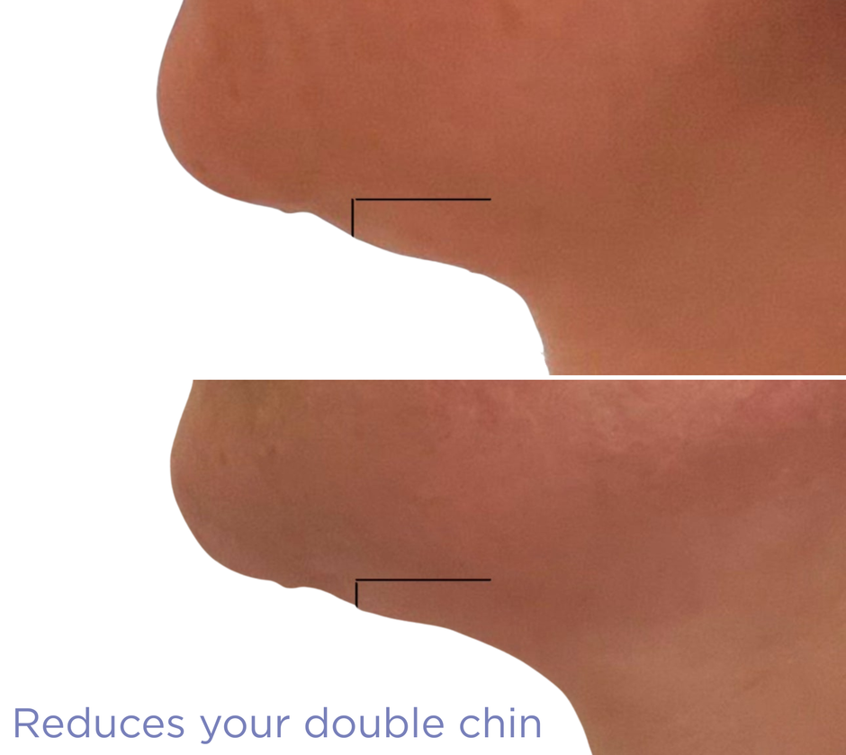 Bundle 3 get 1 free SculptMe Body Tightening Cream