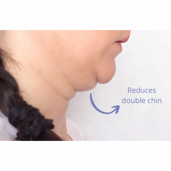 Bundle 3 get 1 free SculptMe-Lipid Dissolve Cream