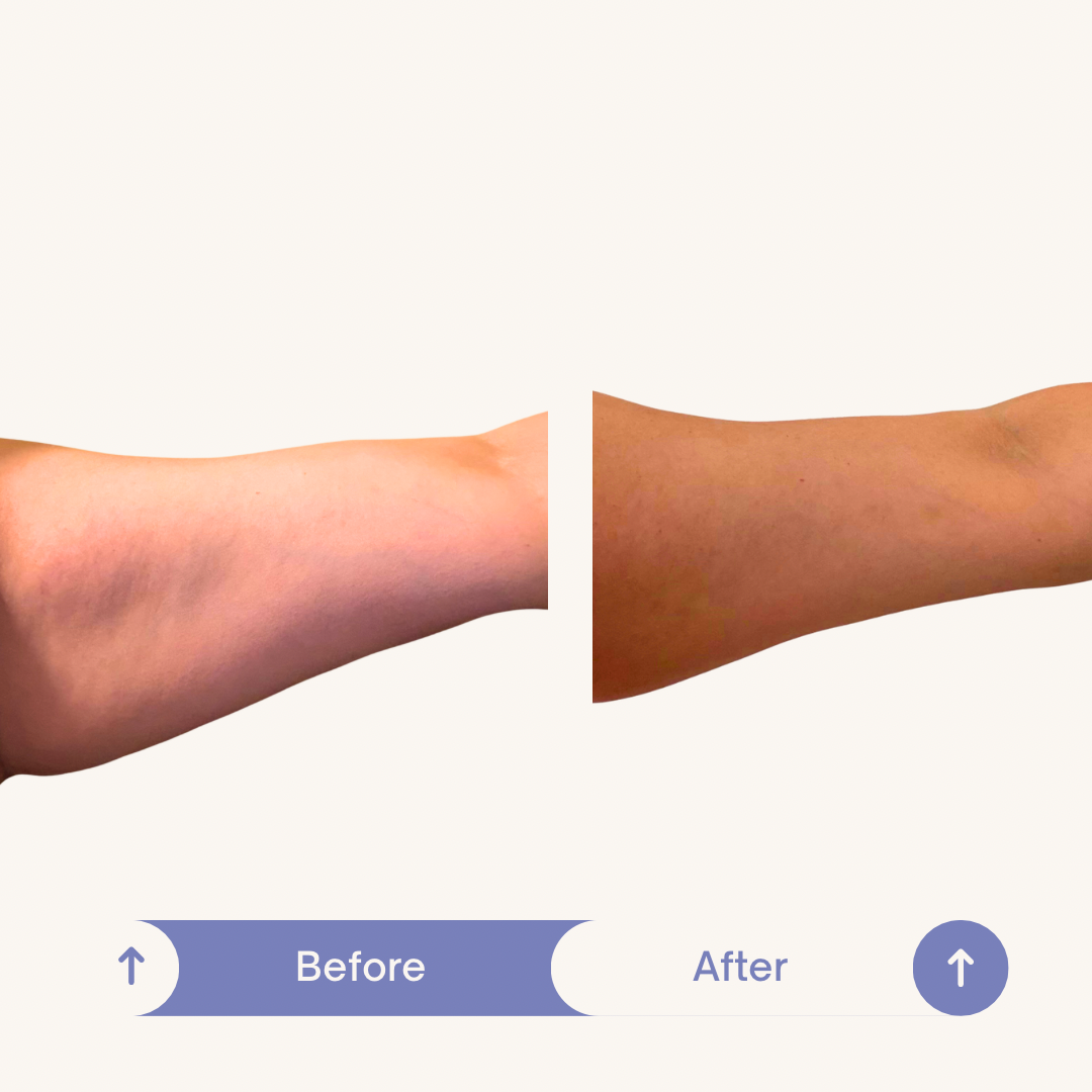 Before and After SculptMe Body Contouring Cream - Aryella Cosmetics™ #