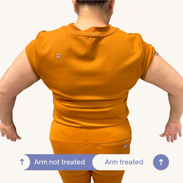 Before and After SculptMe Body Contouring Cream - Aryella Cosmetics™ #