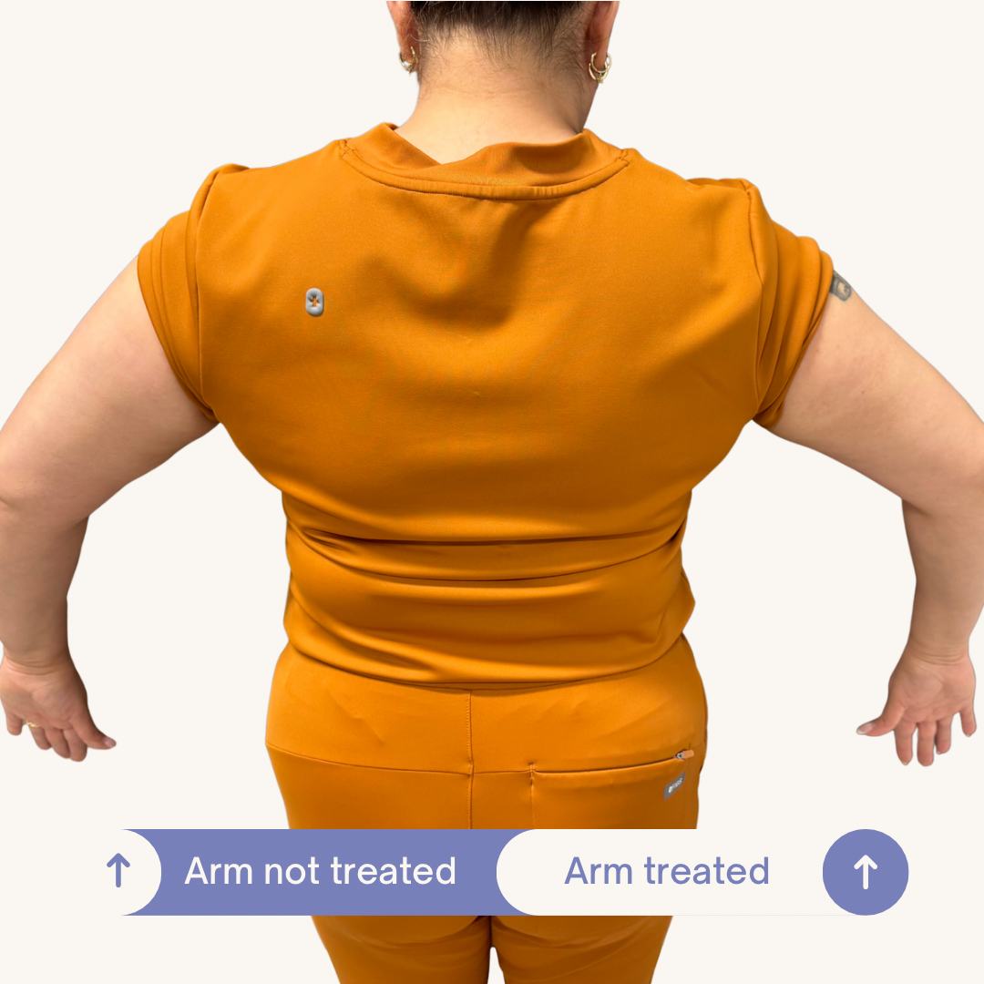 Before and After SculptMe Body Contouring Cream - Aryella Cosmetics™ #