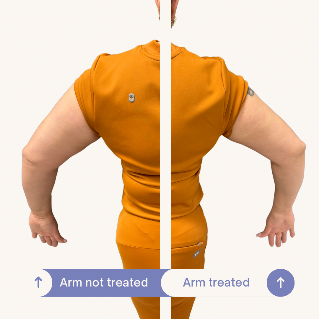 Before and After SculptMe Body Contouring Cream - Aryella Cosmetics™ #