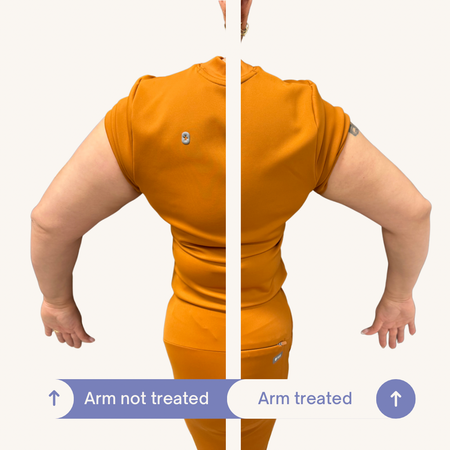 Before and After SculptMe Body Contouring Cream - Aryella Cosmetics™ #